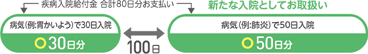 病気(例：胃かいよう)で入院 30日分お支払い 100日後 新たな入院としてお取扱い 病気(例：肺炎)で50日入院 疾病入院給付金80日分お支払い