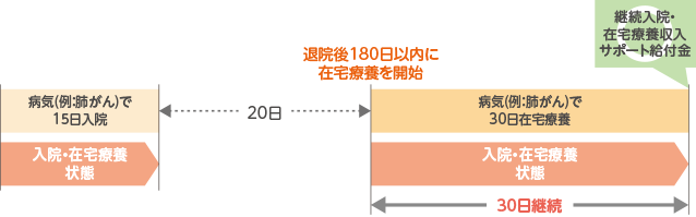 病気(例：肺がん)で15日間入院し、退院後20日間経過してから180日以内に在宅療養を開始し病気(例：肺がん)による在宅療養を30日間継続された場合、継続入院・在宅療養収入サポート給付金をお受け取りいただけます。