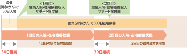 病気(例：肺がん)で30日間入院し、退院日の翌日から病気(例：肺がん)による在宅療養を300日間された場合、1回目の入院・在宅療養状態の給付金対象期間で継続入院・在宅療養収入サポート給付金をお受け取りいただけます。2回目の入院・在宅療養状態の給付金対象期間も給付金をお受け取りいただけます。