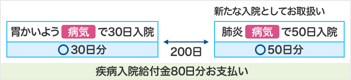 胃かいよう(病気)で30日入院 30日分お支払い 200日後 新たな入院としてお取扱い 肺炎(病気)で50日入院 50日分お支払い 疾病入院給付金80日分お支払い