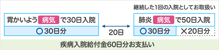 胃かいよう(病気)で30日入院 30日分お支払い 20日後 継続した1回の入院としてお取扱い 肺炎(病気)で50日入院 30日分お支払い 20日分は支払われない 疾病入院給付金60日分お支払い