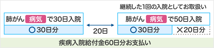 肺がん(病気)で30日入院 30日分お支払い 20日後 肺がん(病気)で50日入院 30日分お支払い 20日分は支払われない 疾病入院給付金60日分お支払い